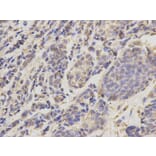 Immunohistochemistry - UBE2I Antibody from Signalway Antibody (32656) - Antibodies.com