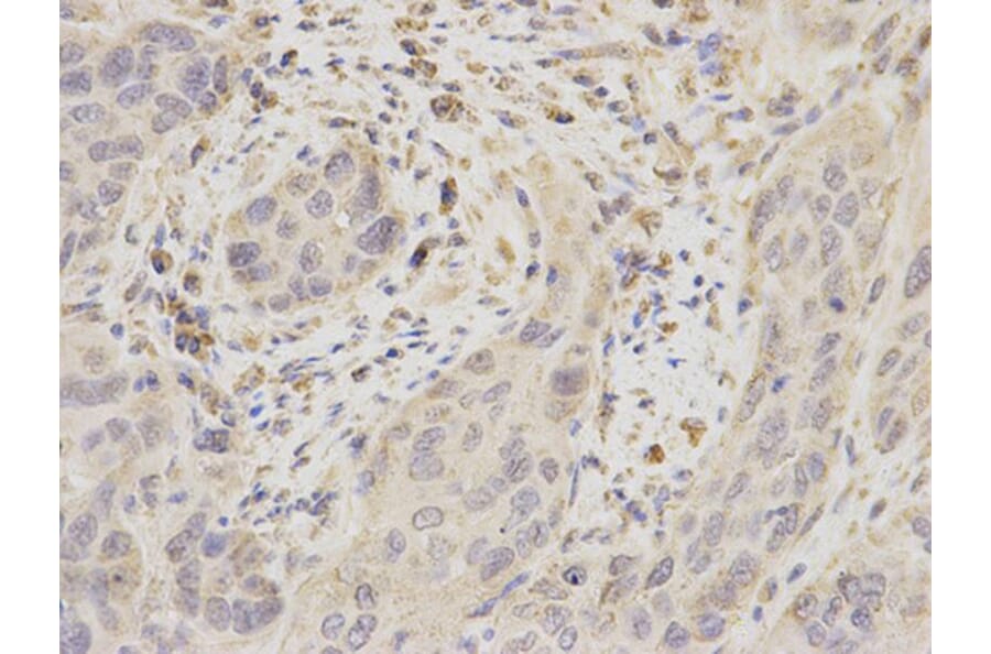 Immunohistochemistry - UBE2I Antibody from Signalway Antibody (32656) - Antibodies.com