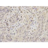 Immunohistochemistry - UBE2I Antibody from Signalway Antibody (32656) - Antibodies.com