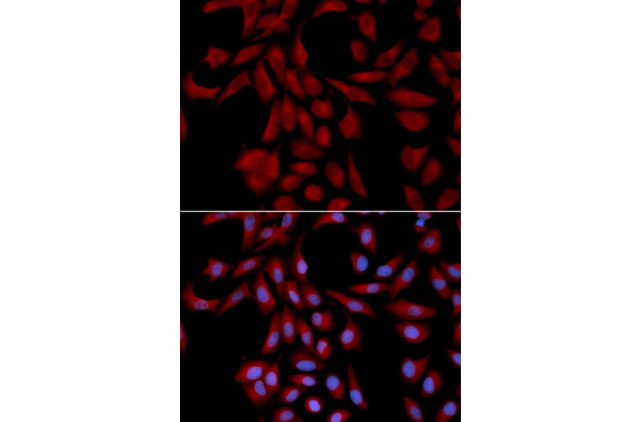 Immunofluorescence - UBE2I Antibody from Signalway Antibody (32656) - Antibodies.com