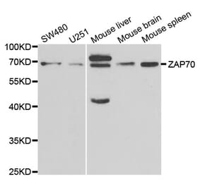 Western blot - ZAP70 Antibody from Signalway Antibody (32657) - Antibodies.com