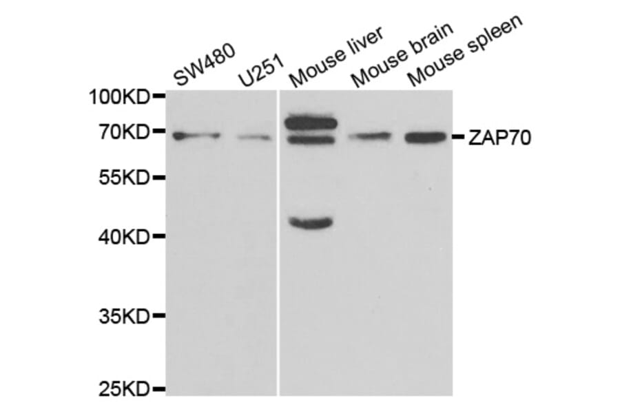 Western blot - ZAP70 Antibody from Signalway Antibody (32657) - Antibodies.com