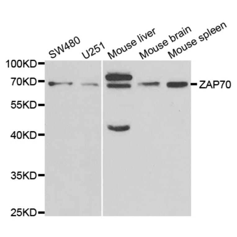 Western blot - ZAP70 Antibody from Signalway Antibody (32657) - Antibodies.com