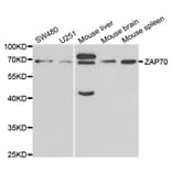 Western blot - ZAP70 Antibody from Signalway Antibody (32657) - Antibodies.com