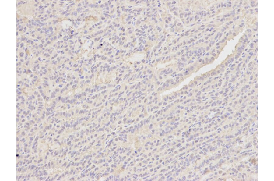 Immunohistochemistry - PCNA Antibody from Signalway Antibody (32052) - Antibodies.com