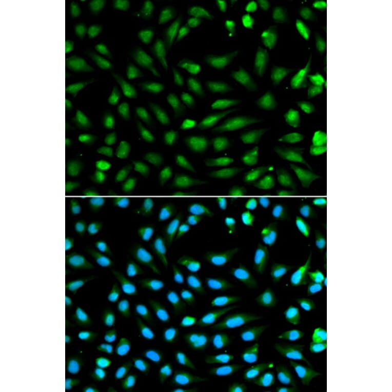 Immunofluorescence - PCNA Antibody from Signalway Antibody (32052) - Antibodies.com