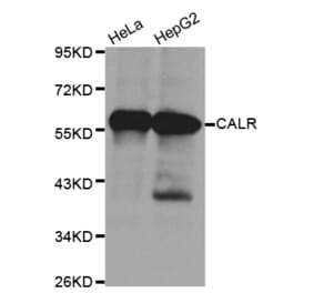 Western blot - CALR Antibody from Signalway Antibody (32141) - Antibodies.com