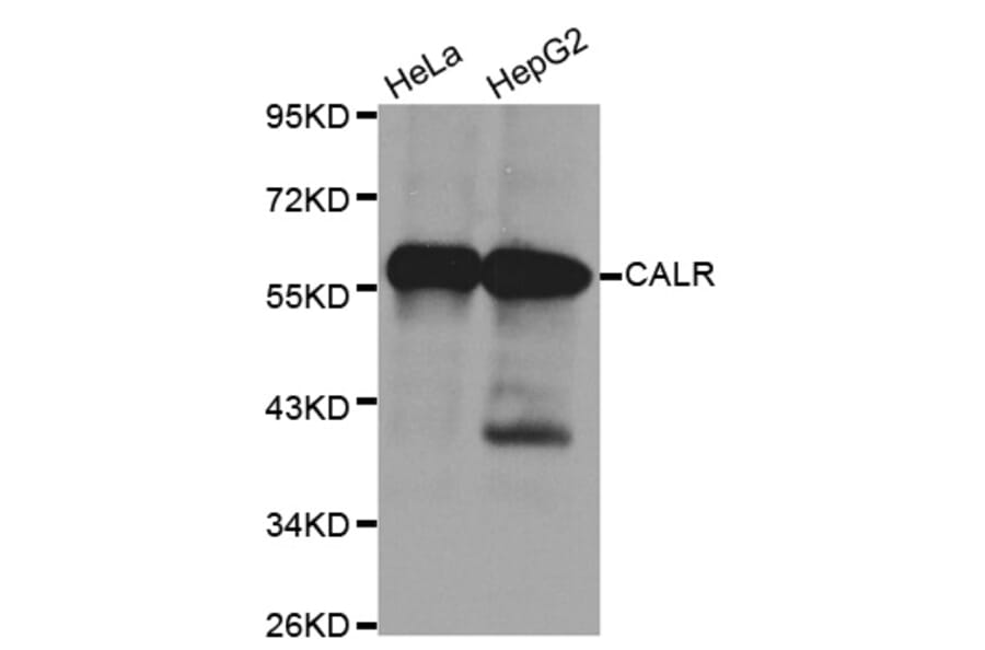 Western blot - CALR Antibody from Signalway Antibody (32141) - Antibodies.com
