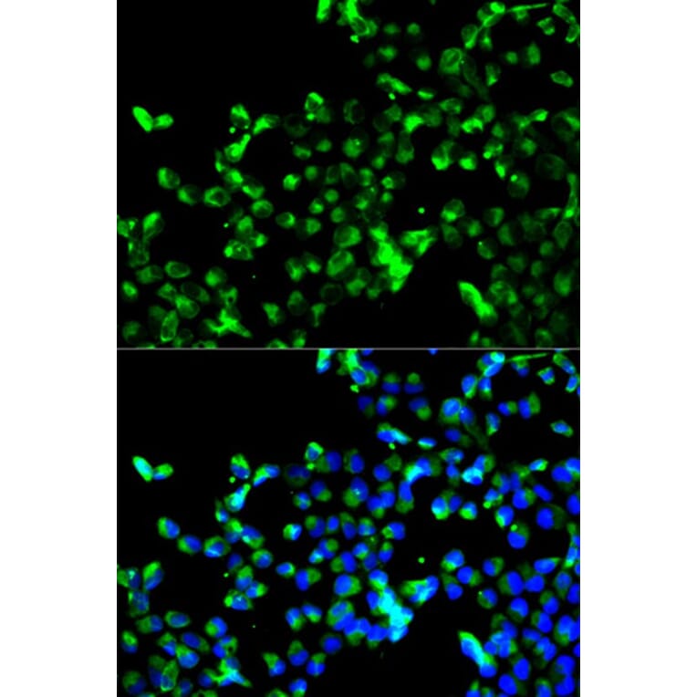 Immunofluorescence - CALR Antibody from Signalway Antibody (32141) - Antibodies.com