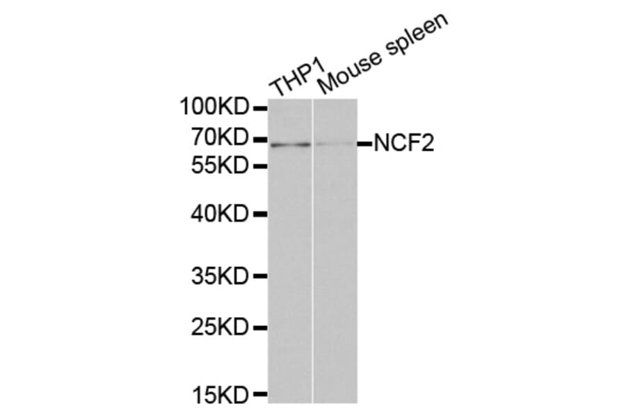 Western blot - NCF2 Antibody from Signalway Antibody (32207) - Antibodies.com
