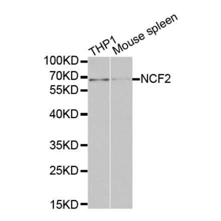 Western blot - NCF2 Antibody from Signalway Antibody (32207) - Antibodies.com