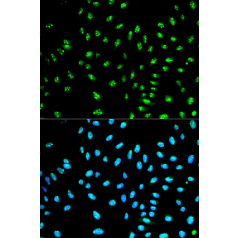 Immunofluorescence - NCF2 Antibody from Signalway Antibody (32207) - Antibodies.com
