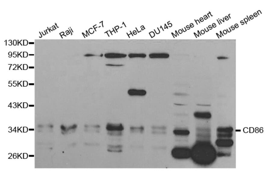 Western blot - CD86 Antibody from Signalway Antibody (32223) - Antibodies.com