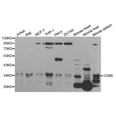 Western blot - CD86 Antibody from Signalway Antibody (32223) - Antibodies.com