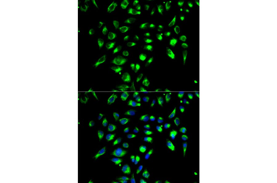 Immunofluorescence - CD86 Antibody from Signalway Antibody (32223) - Antibodies.com