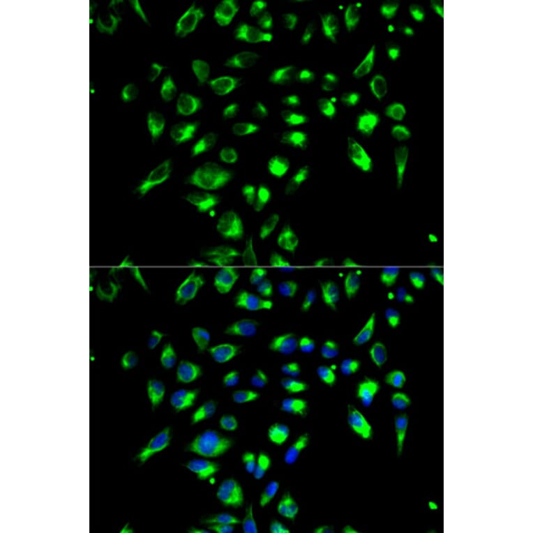 Immunofluorescence - CD86 Antibody from Signalway Antibody (32223) - Antibodies.com