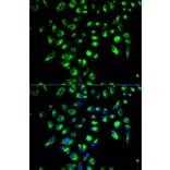 Immunofluorescence - CD86 Antibody from Signalway Antibody (32223) - Antibodies.com
