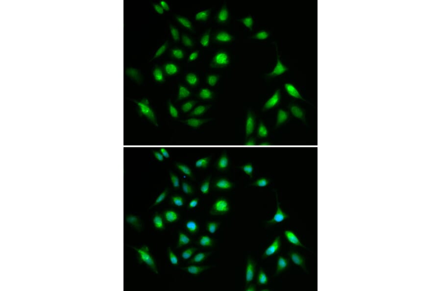 Immunofluorescence - CHUK Antibody from Signalway Antibody (32579) - Antibodies.com