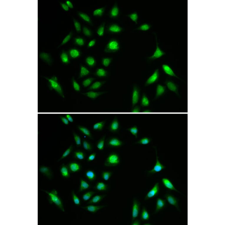 Immunofluorescence - CHUK Antibody from Signalway Antibody (32579) - Antibodies.com