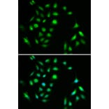 Immunofluorescence - CHUK Antibody from Signalway Antibody (32579) - Antibodies.com