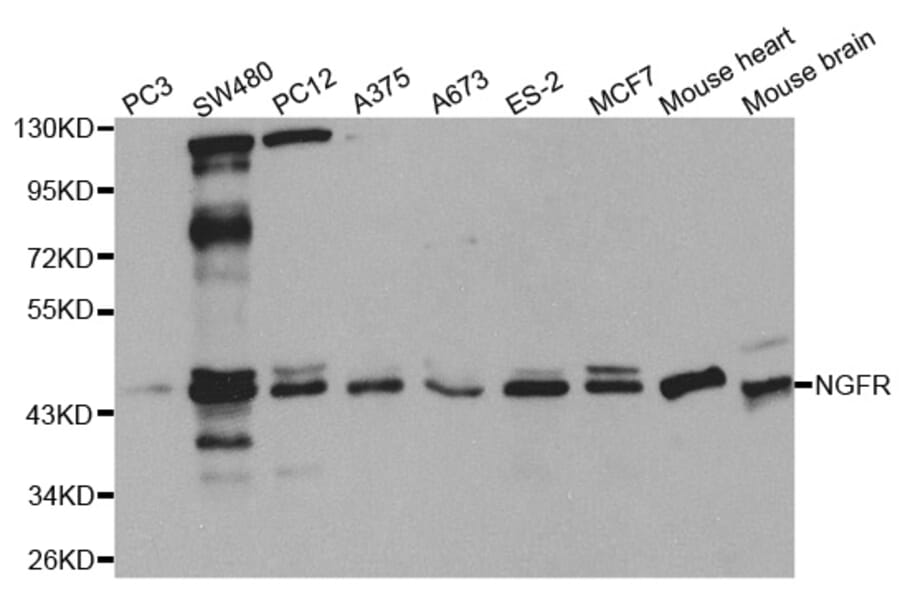 Western blot - NGFR Antibody from Signalway Antibody (32596) - Antibodies.com