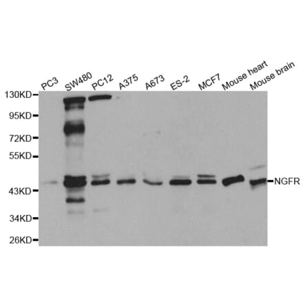 Western blot - NGFR Antibody from Signalway Antibody (32596) - Antibodies.com