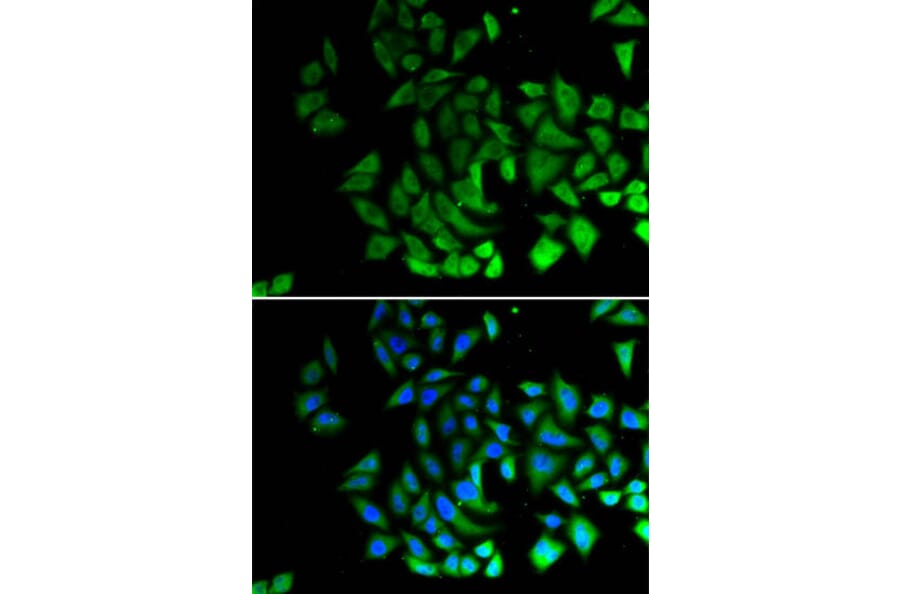 Immunofluorescence - MIWI Antibody from Signalway Antibody (32627) - Antibodies.com