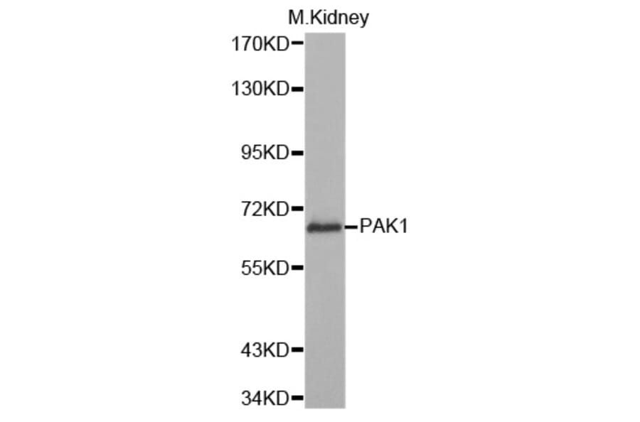 Western blot - PAK1 Antibody from Signalway Antibody (32709) - Antibodies.com
