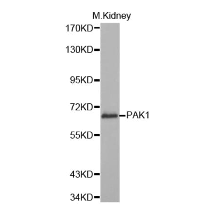 Western blot - PAK1 Antibody from Signalway Antibody (32709) - Antibodies.com
