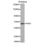 Western blot - PAK1 Antibody from Signalway Antibody (32709) - Antibodies.com