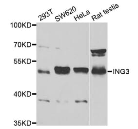 Western blot - ING3 Antibody from Signalway Antibody (33074) - Antibodies.com