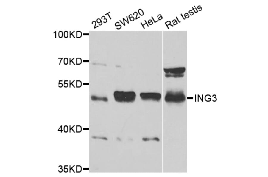 Western blot - ING3 Antibody from Signalway Antibody (33074) - Antibodies.com