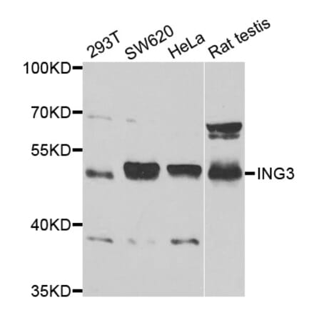 Western blot - ING3 Antibody from Signalway Antibody (33074) - Antibodies.com