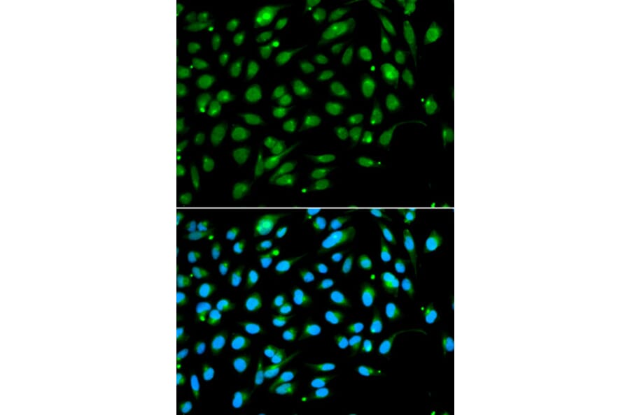 Immunofluorescence - ING3 Antibody from Signalway Antibody (33074) - Antibodies.com
