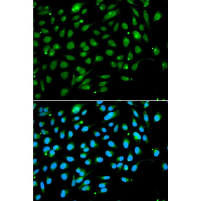 Immunofluorescence - ING3 Antibody from Signalway Antibody (33074) - Antibodies.com