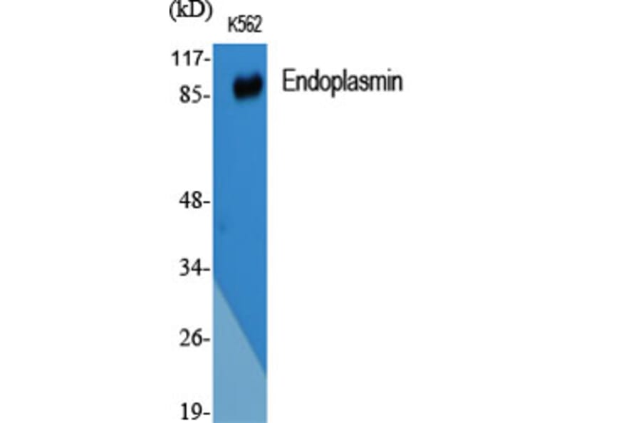Western blot - Endoplasmin Polyclonal Antibody from Signalway Antibody (40883) - Antibodies.com
