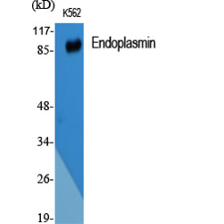 Western blot - Endoplasmin Polyclonal Antibody from Signalway Antibody (40883) - Antibodies.com