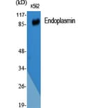 Western blot - Endoplasmin Polyclonal Antibody from Signalway Antibody (40883) - Antibodies.com