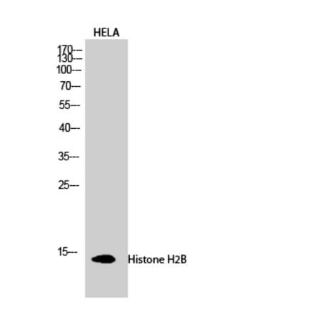 Western blot - Histone H2B Polyclonal Antibody from Signalway Antibody (41014) - Antibodies.com