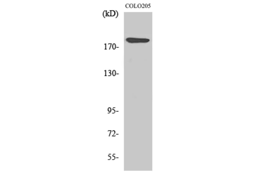 Western blot - Laminin α-4 Polyclonal Antibody from Signalway Antibody (41101) - Antibodies.com