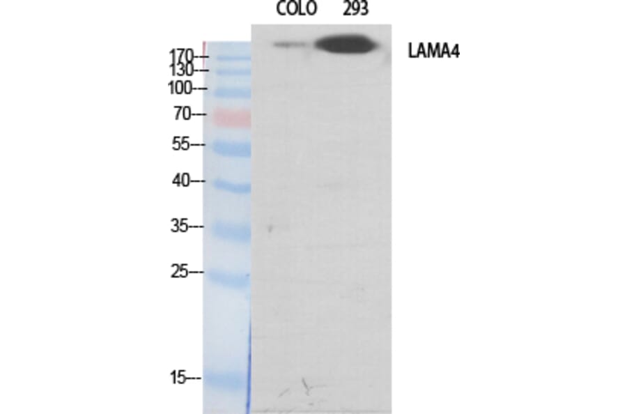 Western blot - Laminin α-4 Polyclonal Antibody from Signalway Antibody (41101) - Antibodies.com