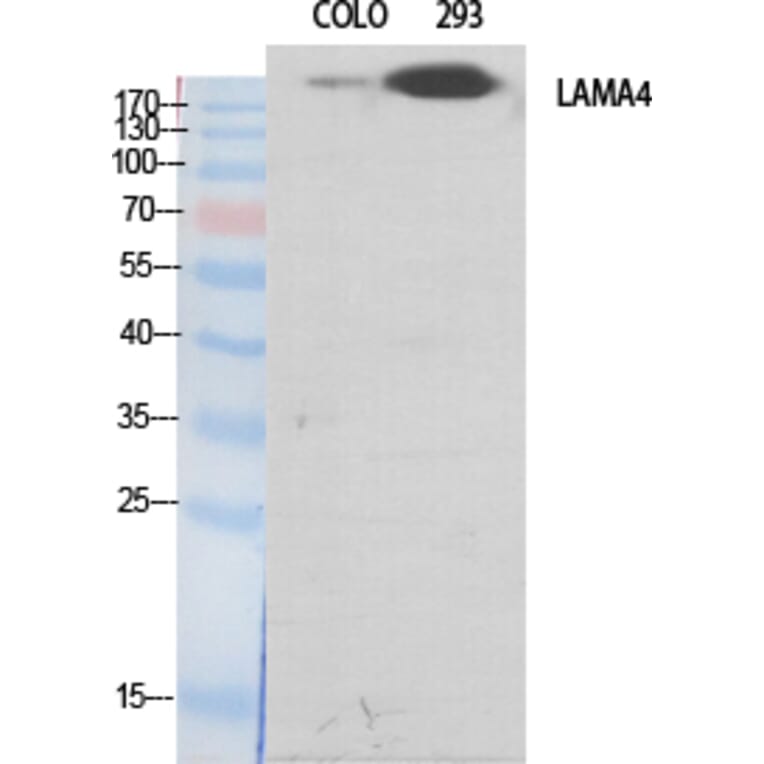 Western blot - Laminin α-4 Polyclonal Antibody from Signalway Antibody (41101) - Antibodies.com