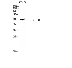 Western blot - PTH/PTHrP-R Polyclonal Antibody from Signalway Antibody (41368) - Antibodies.com
