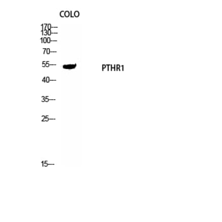 Western blot - PTH/PTHrP-R Polyclonal Antibody from Signalway Antibody (41368) - Antibodies.com