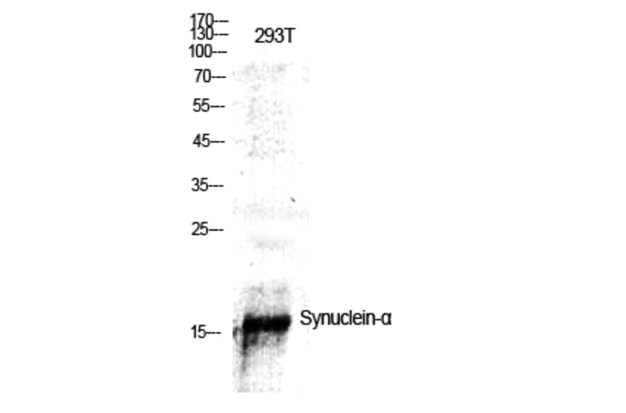 Western blot - Synuclein-α Polyclonal Antibody from Signalway Antibody (41474) - Antibodies.com