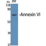 Western blot - Annexin VI Polyclonal Antibody from Signalway Antibody (40594) - Antibodies.com