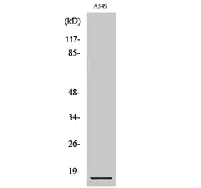Western blot - Cystatin B Polyclonal Antibody from Signalway Antibody (40819) - Antibodies.com