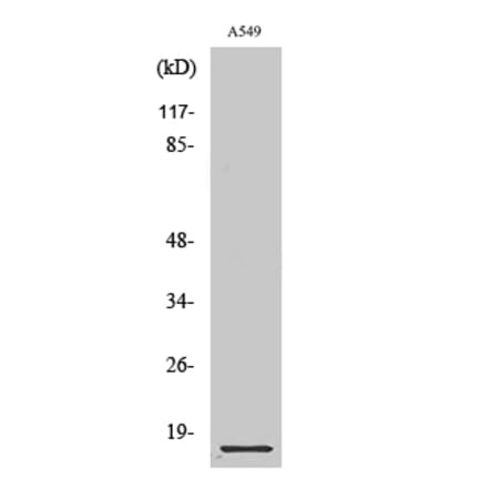 Western blot - Cystatin B Polyclonal Antibody from Signalway Antibody (40819) - Antibodies.com