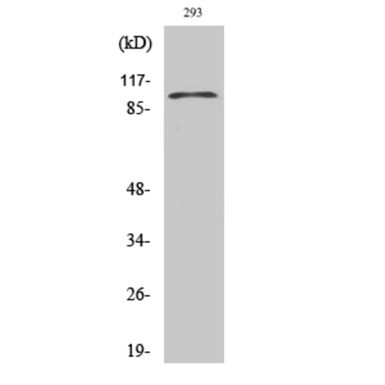 Western blot - E-cadherin Polyclonal Antibody from Signalway Antibody (40859) - Antibodies.com