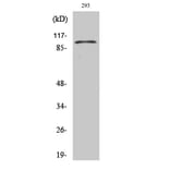 Western blot - E-cadherin Polyclonal Antibody from Signalway Antibody (40859) - Antibodies.com